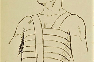 Уход за хирургическим больным на дому. Краткий справочник. 1941