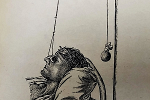 Огнестрельные ранения лица и челюстей и их лечение. 1941